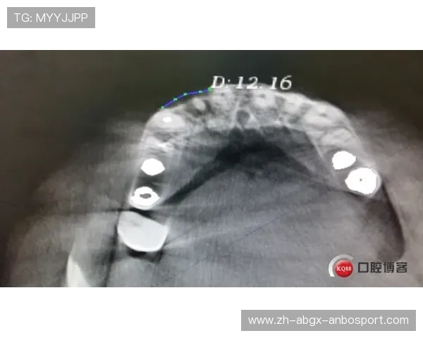 勇士队利好科尔称穆迪伤情仅限髌腱未伤及软骨骨头简化手术
